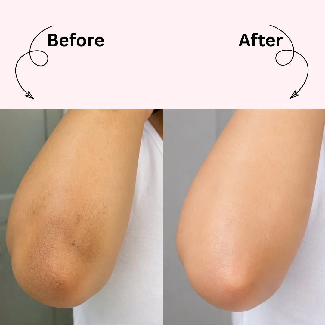 Dr. Melaxin Peel Shot : Brightening Body Spray in Seconds, Not Sessions