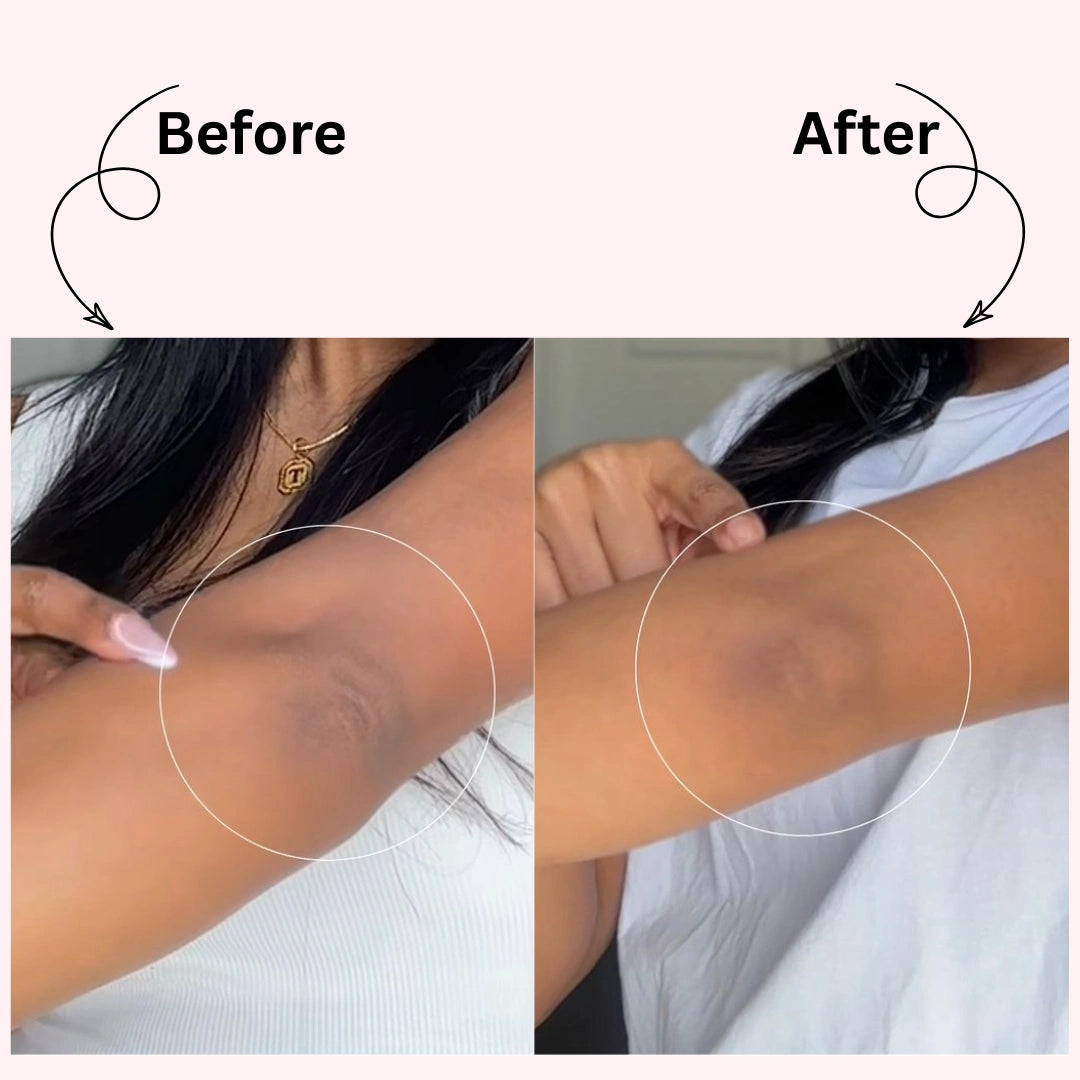 Dr. Melaxin Peel Shot : Brightening Body Spray in Seconds, Not Sessions