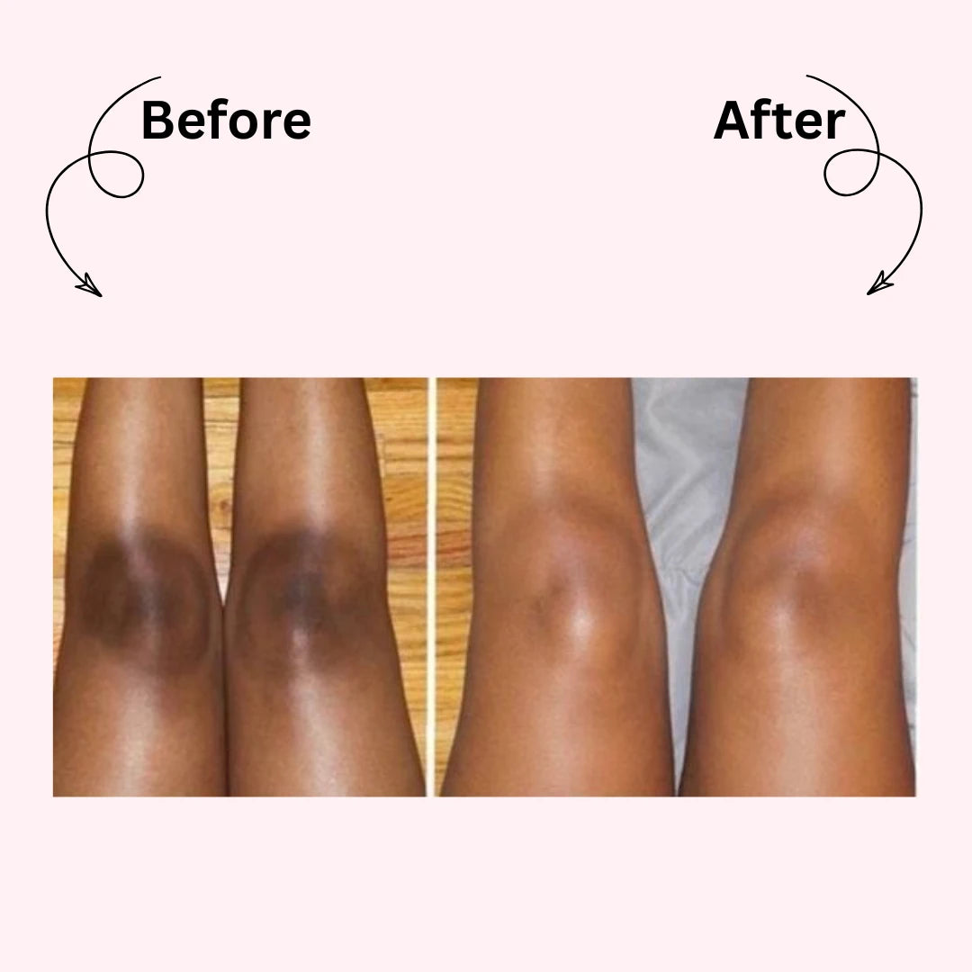 Dr. Melaxin Peel Shot : Brightening Body Spray in Seconds, Not Sessions